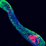 Melanocytes in a hair follicle
