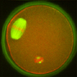 Oocyte and somatic spindles following nuclear transfer