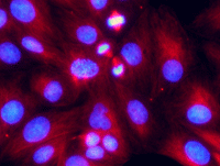 蛍光染色した細胞1