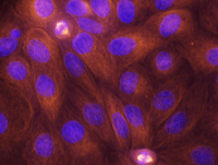 蛍光染色した細胞1